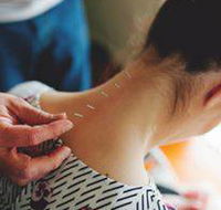 Scott Martin Acupuncture - Suburb Australia
