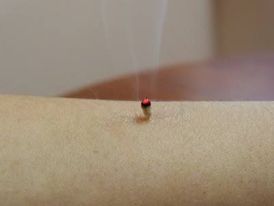 Acupuncture @ Beerwah - Suburb Australia 1