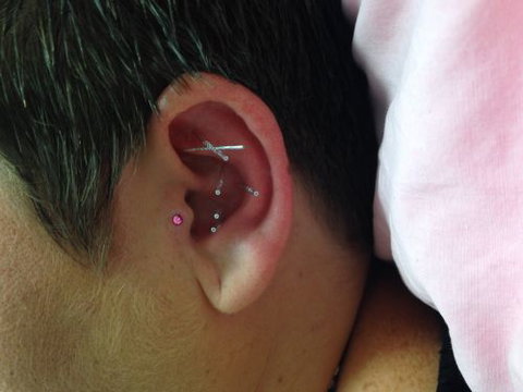 Acupuncture @ Beerwah - Suburb Australia 3