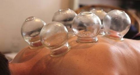 Acupuncture @ Beerwah - Suburb Australia 4