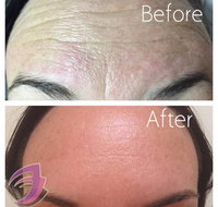 Evolve Medical Aesthetics Weight Loss - Suburb Australia