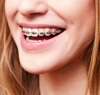 Cairns Specialist Orthodontists - Suburb Australia