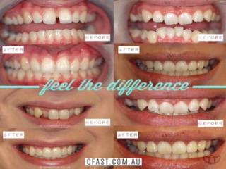 Fresh Dental Care - Suburb Australia 6