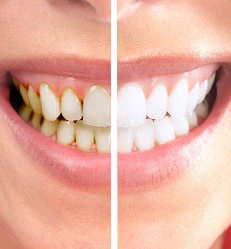 Dentists Beresfield NSW Suburb Australia