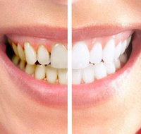 Graham Johnson Dental Surgeon - Suburb Australia
