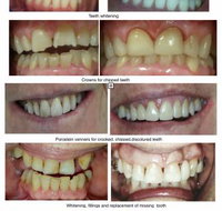 Smile Craft Dental - Suburb Australia