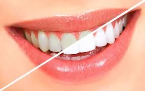 Dental Centre Maroochydore - Suburb Australia 2