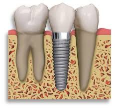 Dental Centre Maroochydore - Suburb Australia 3