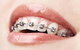 Dental Centre Maroochydore - thumb 4