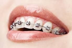 Dental Centre Maroochydore - Suburb Australia 4
