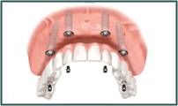 Denture Success - Suburb Australia 2