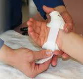 Central Coast Hand Upper Limb Therapy - Suburb Australia