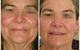 PRISTINE EASTERN Chinese Herbal Massage And Beauty Clinic - thumb 0